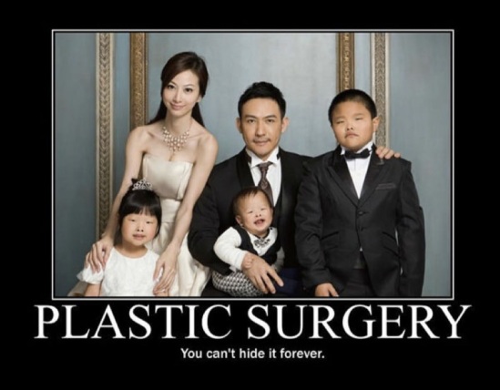 plastic surgery ugly asian kids